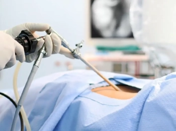 Laparoskopik Safra Kesesi Ameliyatı Avantajı Nedir?